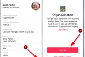 Organi Donor